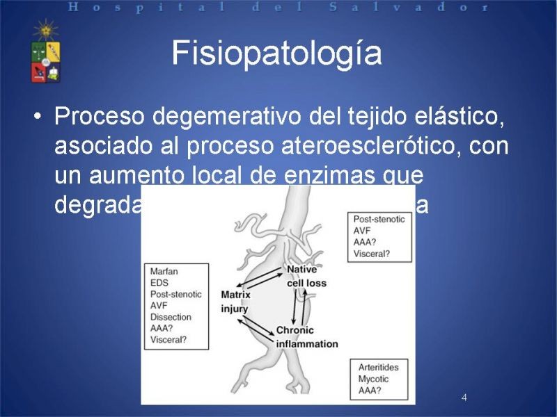 Diapositiva 3 de Aneurismas periféricos