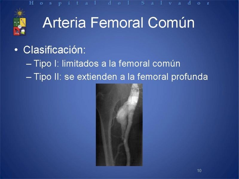 Diapositiva 9 de Aneurismas periféricos