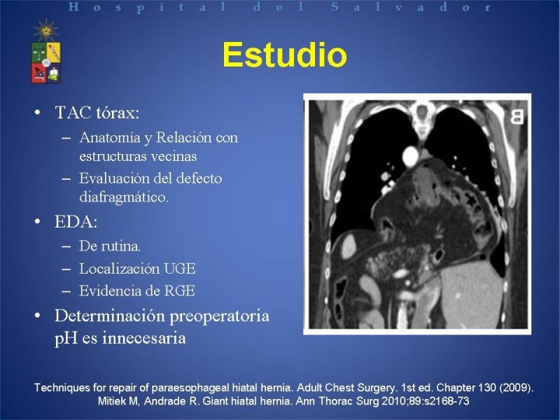 Diapositiva 19 de Hernia Hiatal