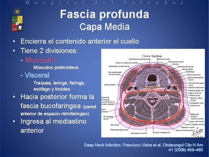 Diapositiva 6 de Abscesos Cervicales Profundos
