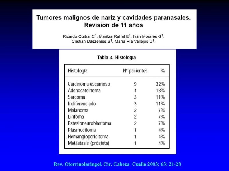 Diapositiva 14 de Tumores de Senos Paranasales