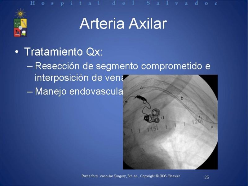 Diapositiva 24 de Aneurismas periféricos