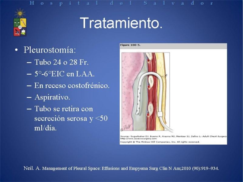 Diapositiva 11 de Empiema Pleural: Paraneumónico, posquirúrgico y post resección pulmonar. Tratamiento quirúrgico.