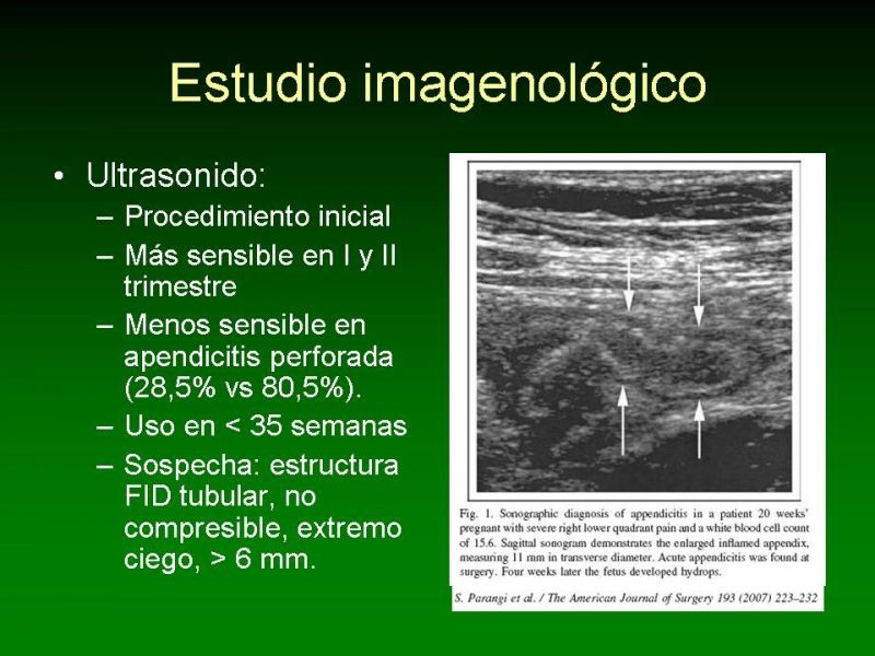 Diapositiva 12 de Apendicitis Aguda y Embarazo