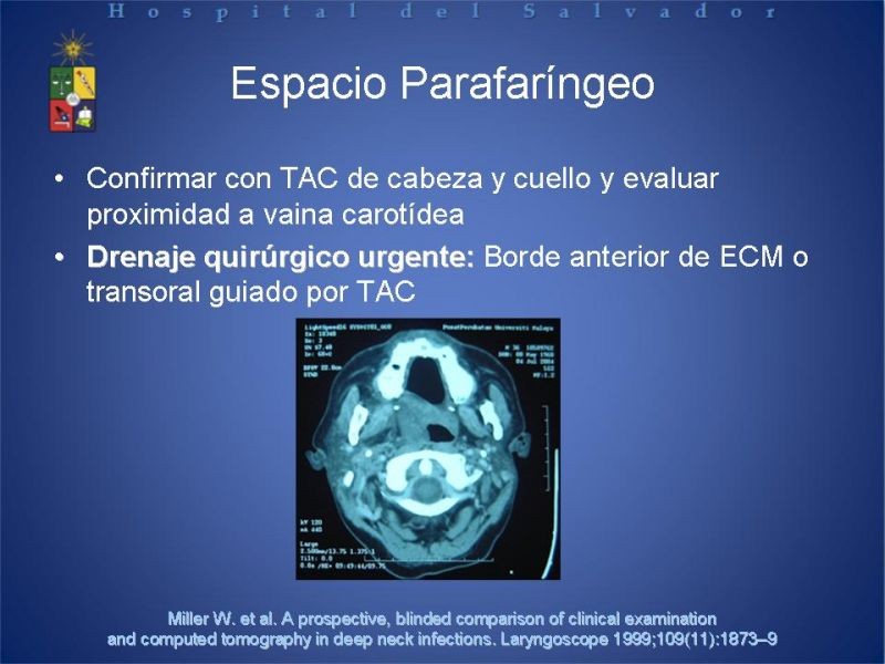 Diapositiva 17 de Abscesos Cervicales Profundos