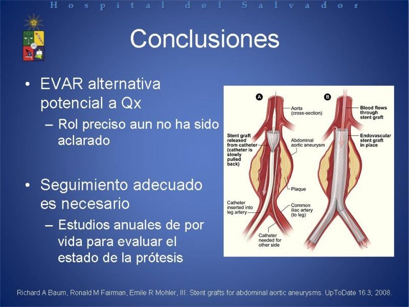 Diapositiva 28 de Manejo Endovascular del AAA (EVAR)