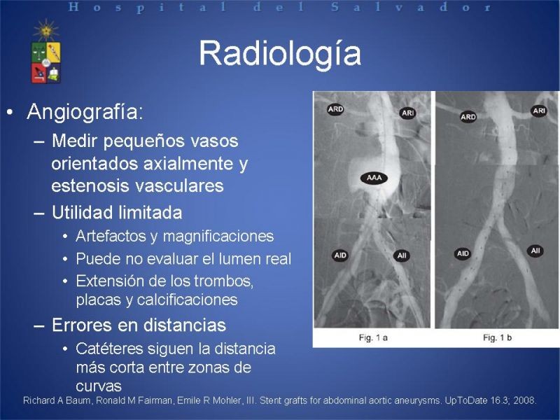 Diapositiva 15 de Manejo Endovascular del AAA (EVAR)