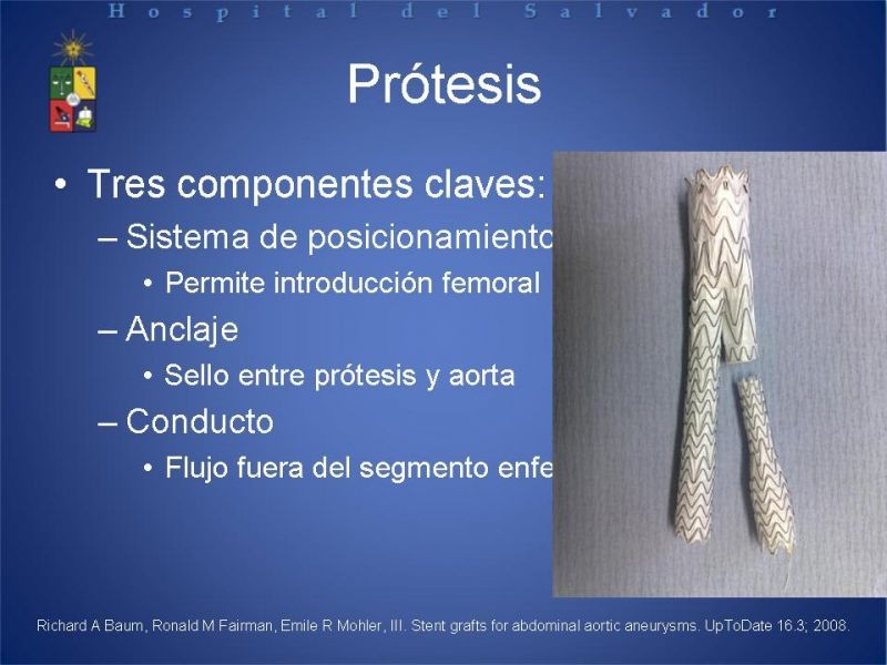 Diapositiva 4 de Manejo Endovascular del AAA (EVAR)