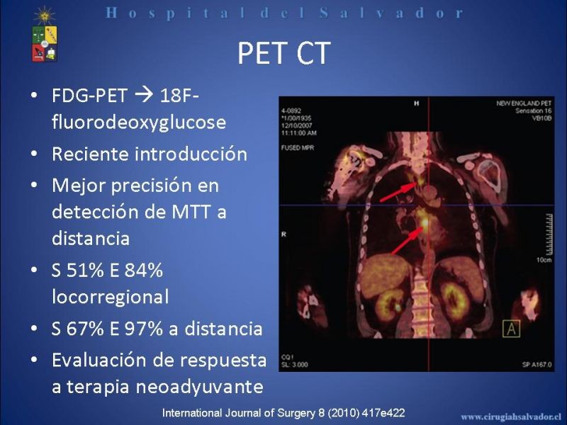 Diapositiva 24 de Cáncer de Esófago: Diagnóstico y etapificación