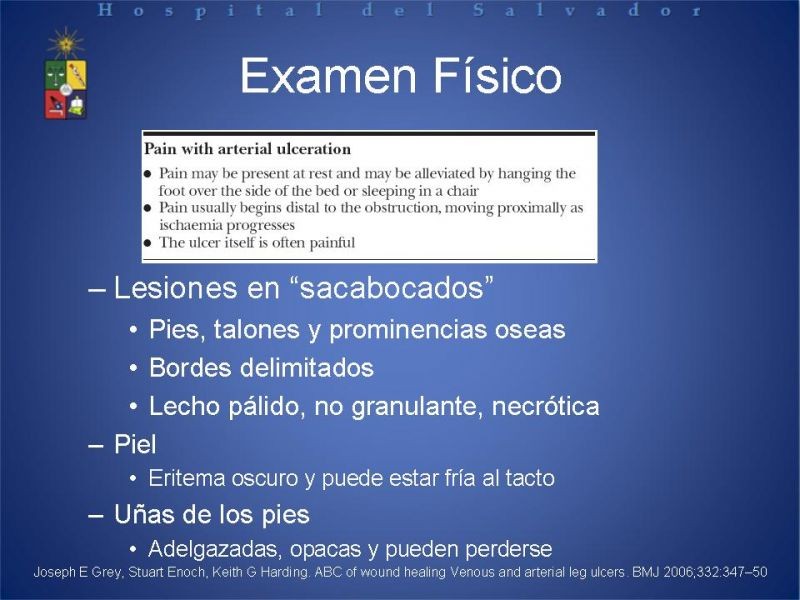 Diapositiva 18 de Úlceras de EEII