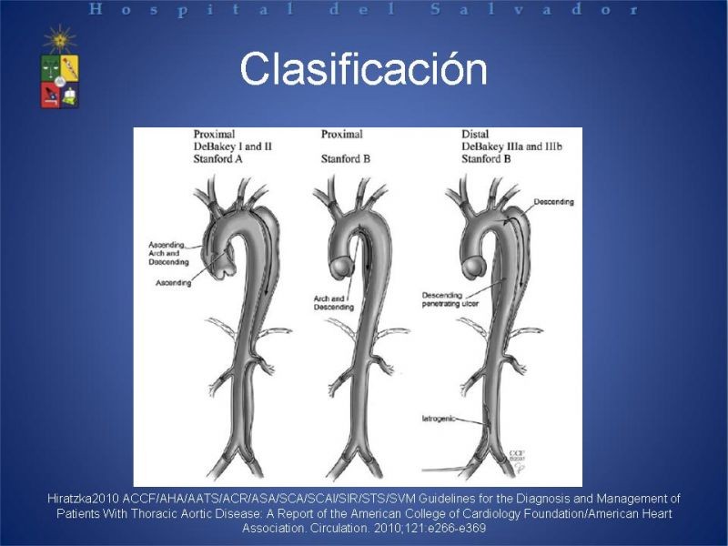 Diapositiva 6 de Disección Aortica tipo A