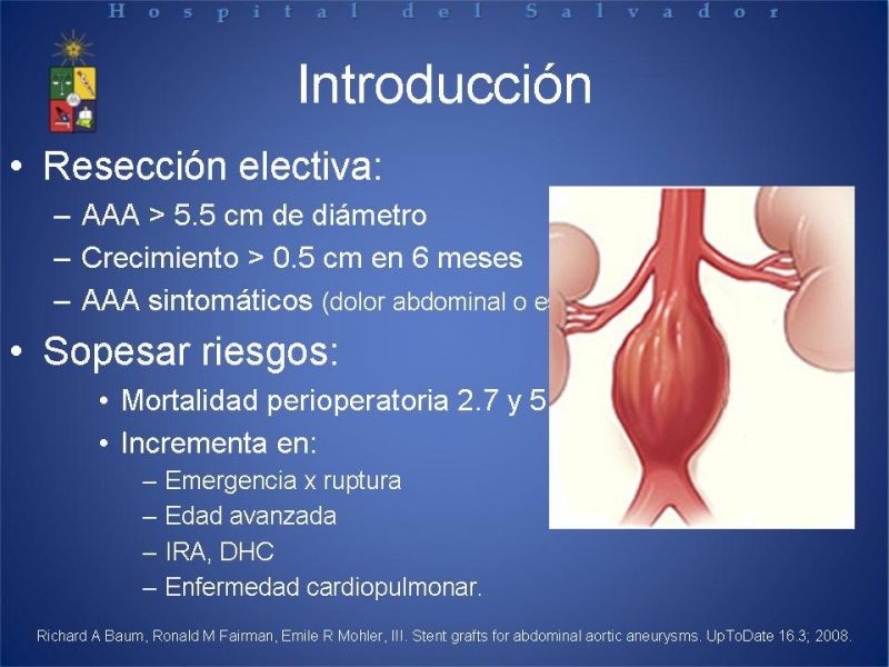 Diapositiva 2 de Manejo Endovascular del AAA (EVAR)