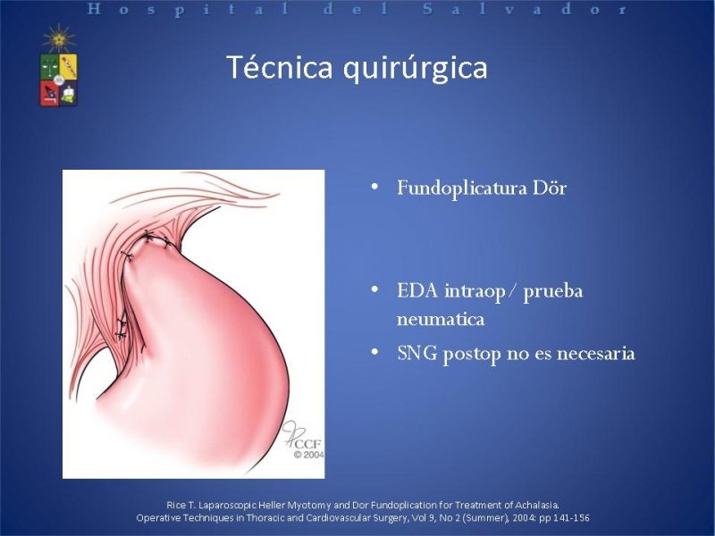 Diapositiva 23 de Manejo laparoscópico de la Acalasia