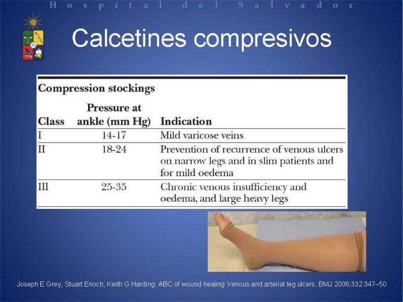 Diapositiva 10 de Úlceras de EEII