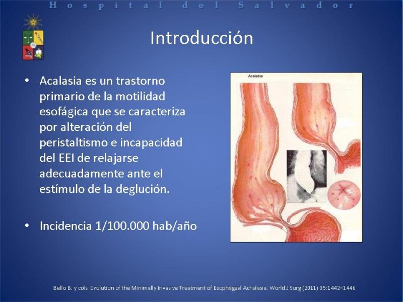 Diapositiva 1 de Manejo laparoscópico de la Acalasia