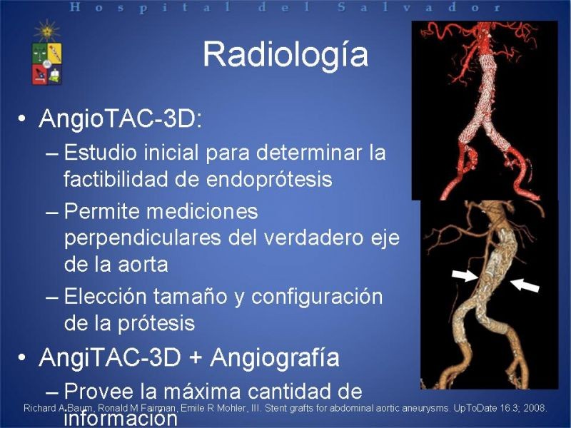 Diapositiva 16 de Manejo Endovascular del AAA (EVAR)