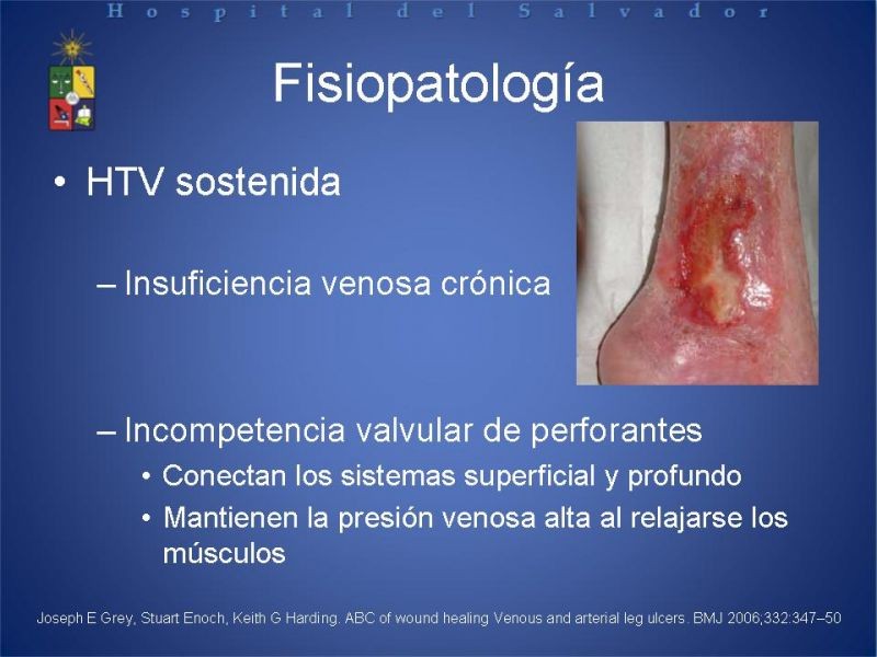 Diapositiva 2 de Úlceras de EEII