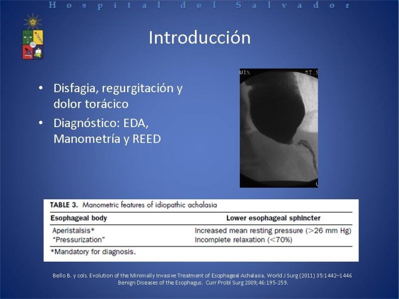 Diapositiva 2 de Manejo laparoscópico de la Acalasia