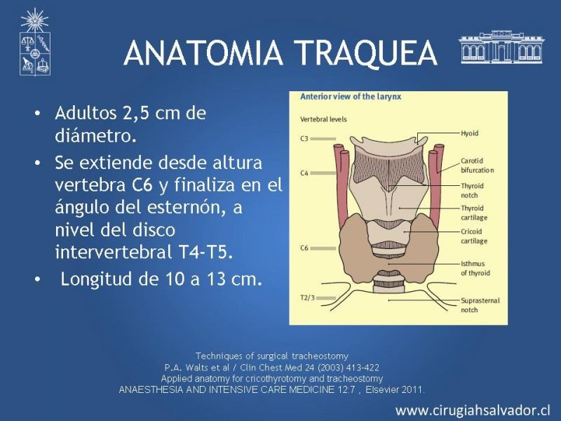 Diapositiva 9 de Traqueostomía
