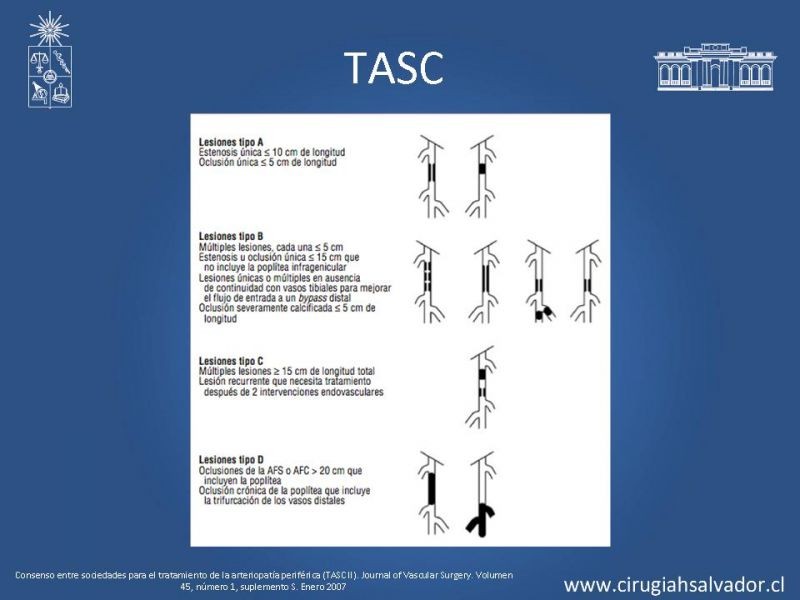 Diapositiva 7 de Manejo quirúrgico de la enfermedad arterial infrainguinal: Accesos 