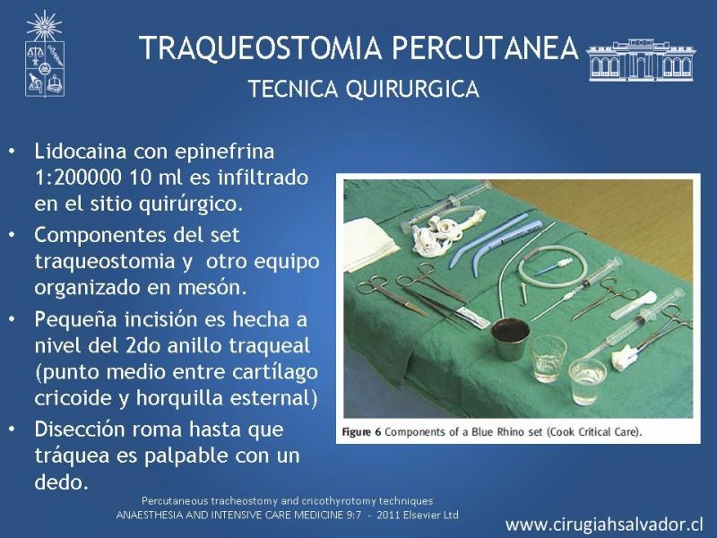 Diapositiva 23 de Traqueostomía