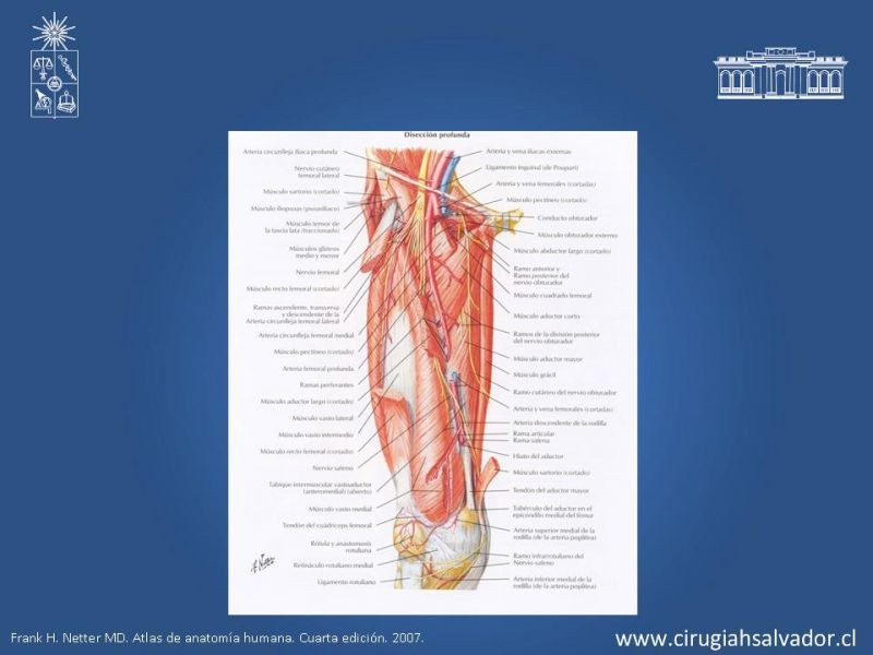 Diapositiva 18 de Manejo quirúrgico de la enfermedad arterial infrainguinal: Accesos 