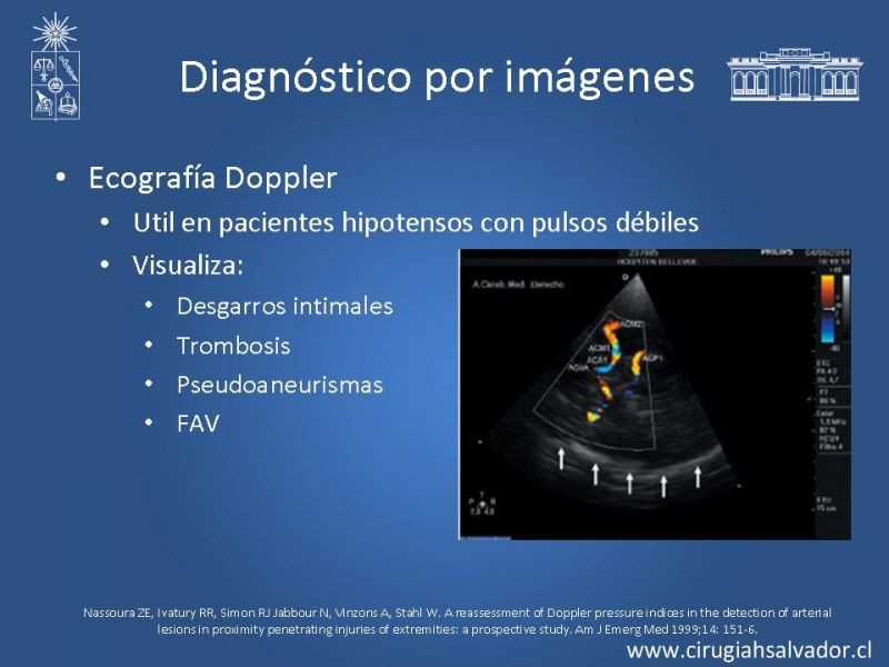 Diapositiva 14 de Trauma vascular periférico