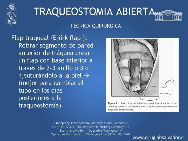 Diapositiva 17 de Traqueostomía