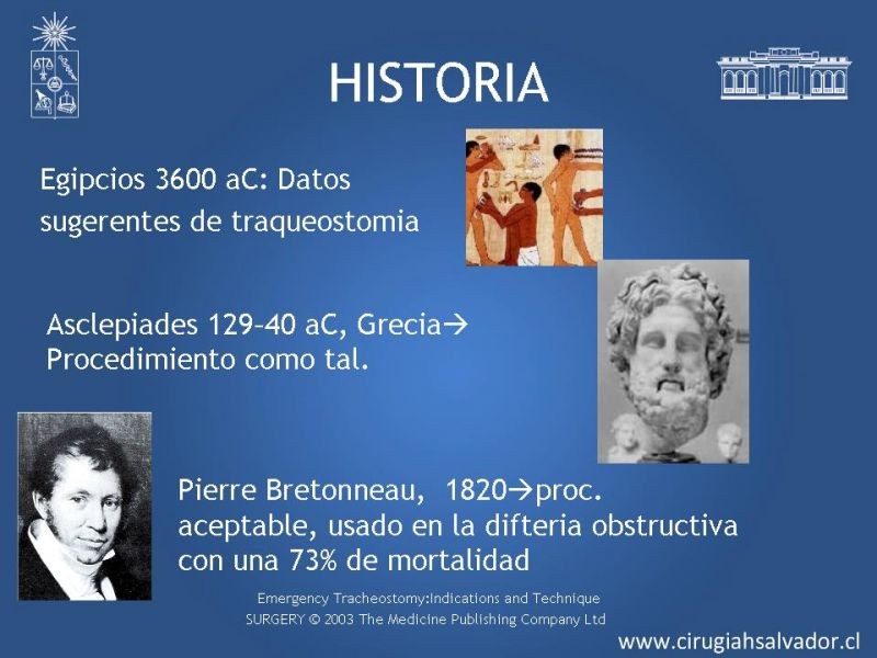 Diapositiva 3 de Traqueostomía
