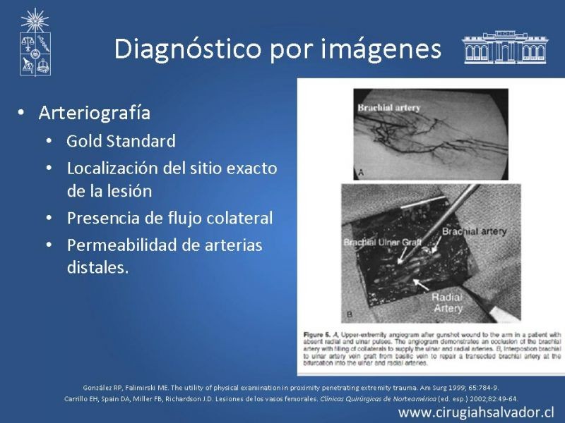 Diapositiva 12 de Trauma vascular periférico