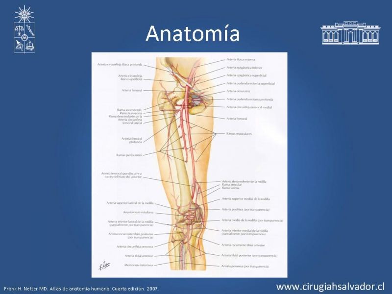 Diapositiva 12 de Manejo quirúrgico de la enfermedad arterial infrainguinal: Accesos 