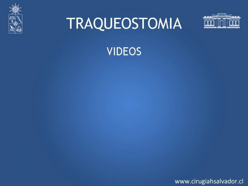 Diapositiva 33 de Traqueostomía