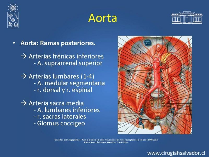 Diapositiva 2 de Anatomía e Imagenología Vascular Arterial Intra-abdominal