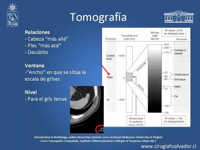 Diapositiva 19 de Anatomía Quirúrgica y Radiología Aplicada