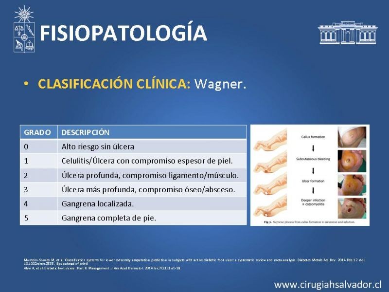 Diapositiva 3 de Pie diabético: Manejo