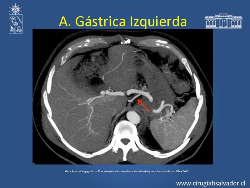 Diapositiva 25 de Anatomía e Imagenología Vascular Arterial Intra-abdominal