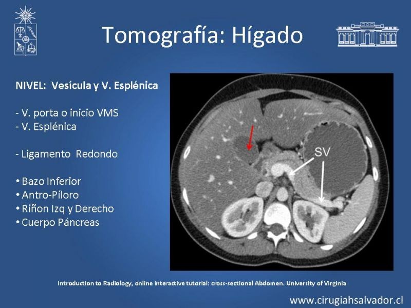 Diapositiva 30 de Anatomía Quirúrgica y Radiología Aplicada