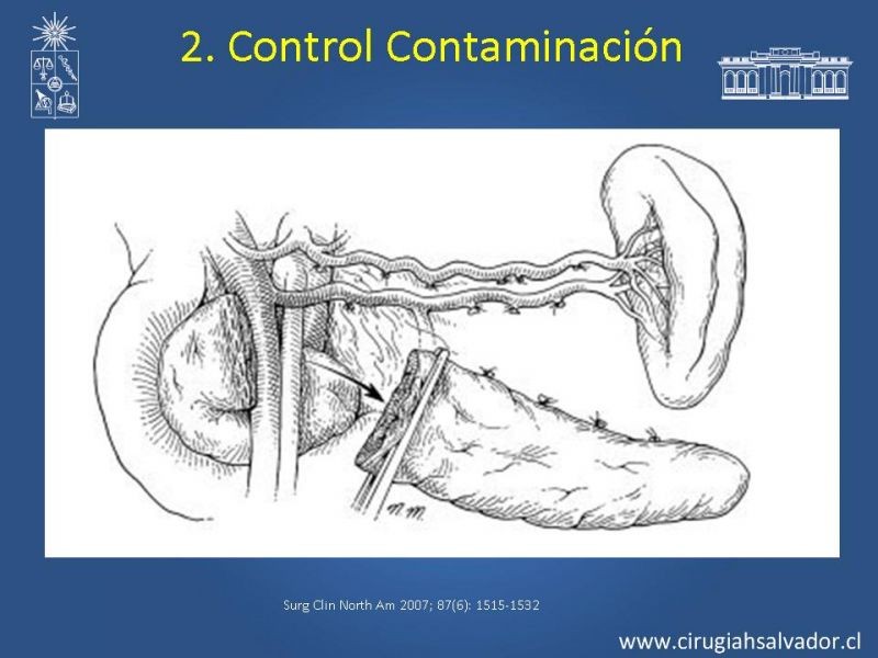 Diapositiva 37 de Damage Control Surgery (técnica quirúrgica) pt. 2