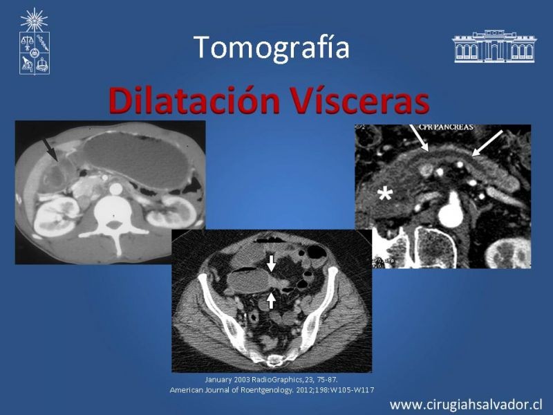Diapositiva 40 de Anatomía Quirúrgica y Radiología Aplicada