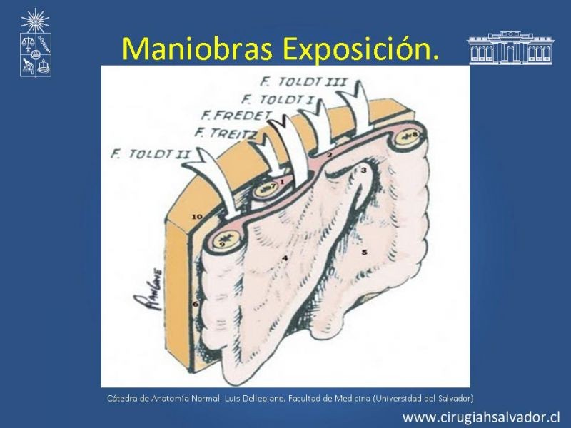 Diapositiva 12 de Damage Control Surgery (técnica quirúrgica) pt. 1