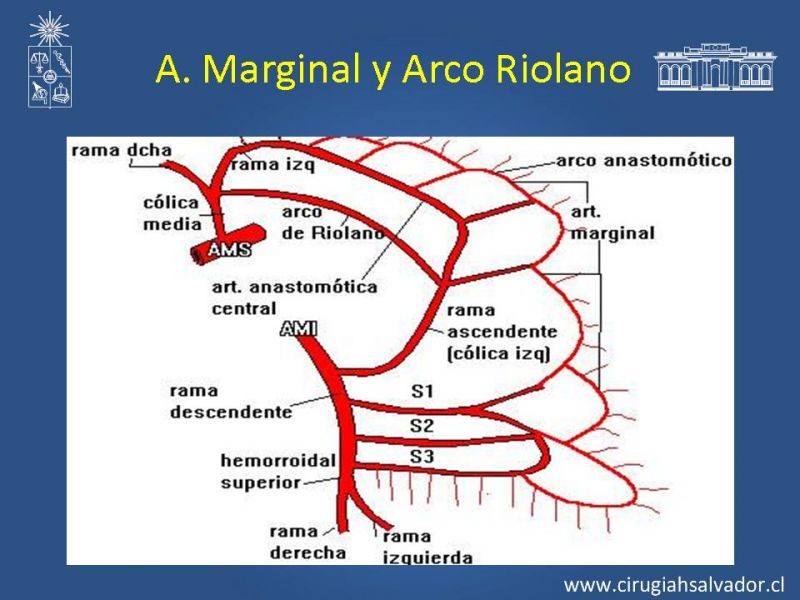 Diapositiva 39 de Anatomía e Imagenología Vascular Arterial Intra-abdominal