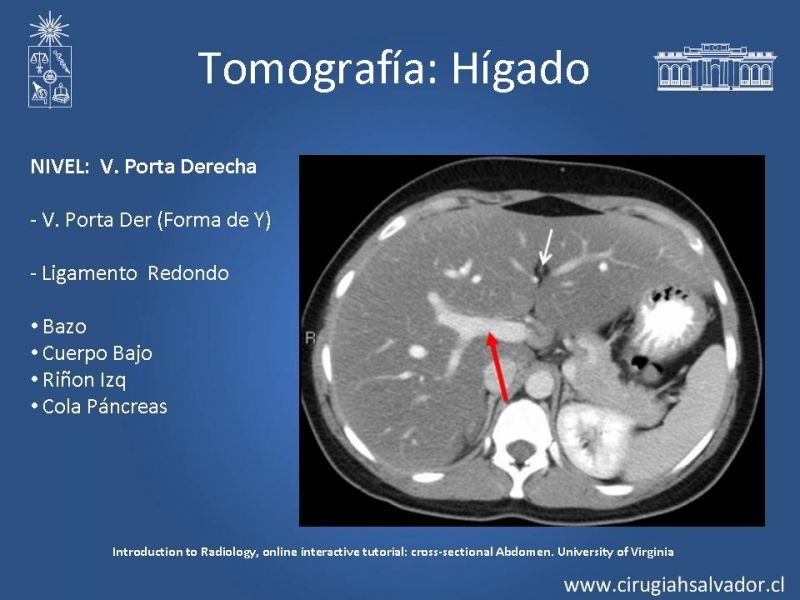 Diapositiva 28 de Anatomía Quirúrgica y Radiología Aplicada