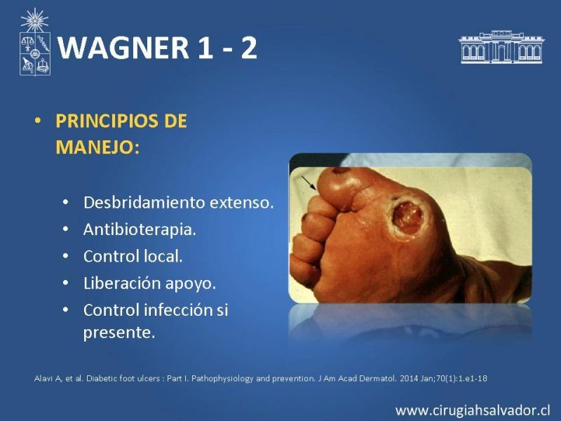 Diapositiva 7 de Pie diabético: Manejo