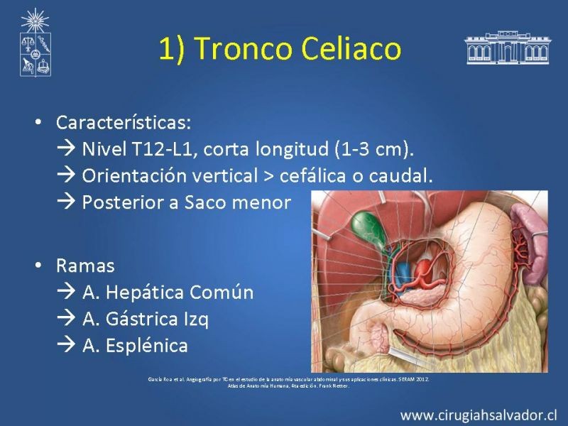 Diapositiva 8 de Anatomía e Imagenología Vascular Arterial Intra-abdominal