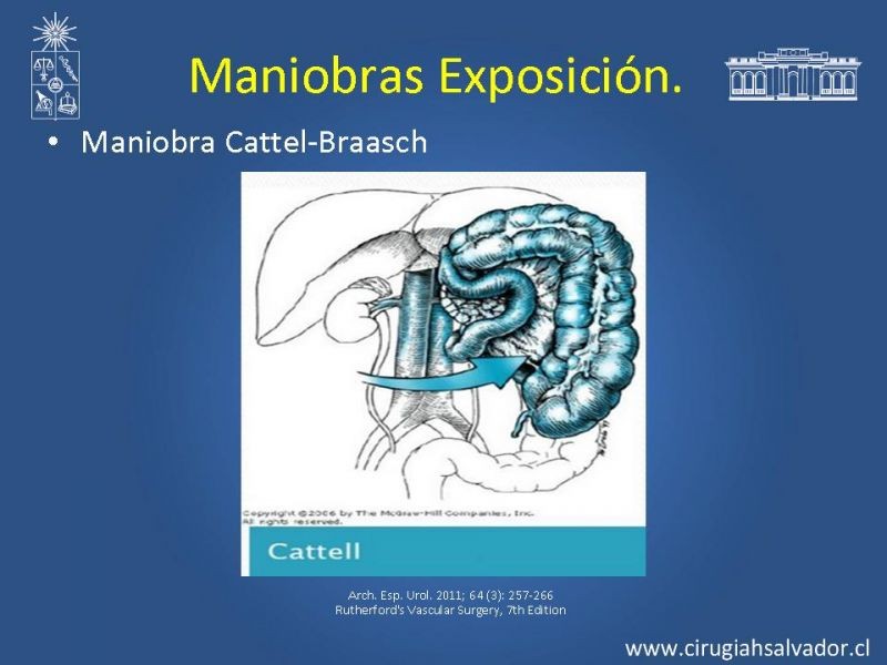 Diapositiva 14 de Damage Control Surgery (técnica quirúrgica) pt. 1