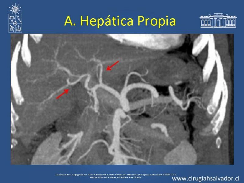 Diapositiva 17 de Anatomía e Imagenología Vascular Arterial Intra-abdominal