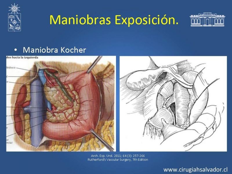 Diapositiva 13 de Damage Control Surgery (técnica quirúrgica) pt. 1