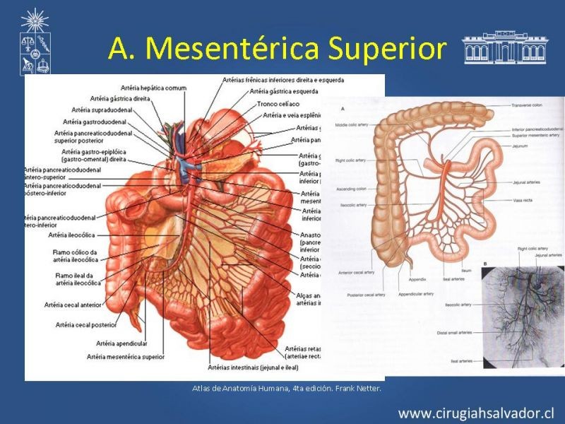 Diapositiva 46 de Damage Control Surgery (técnica quirúrgica) pt. 3