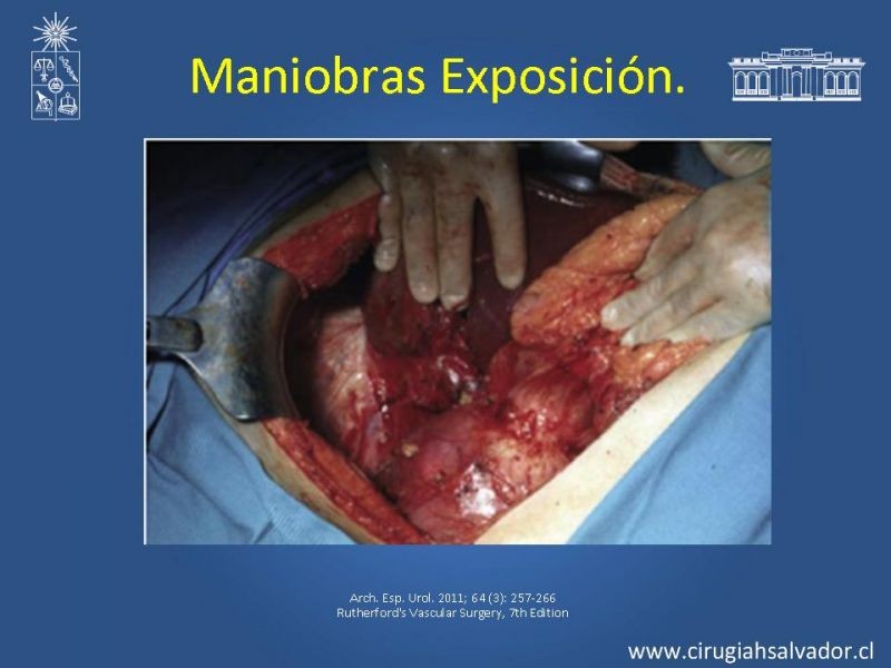 Diapositiva 15 de Damage Control Surgery (técnica quirúrgica) pt. 1