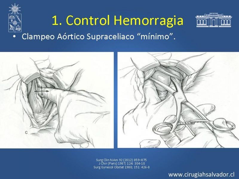 Diapositiva 10 de Damage Control Surgery (técnica quirúrgica) pt. 1